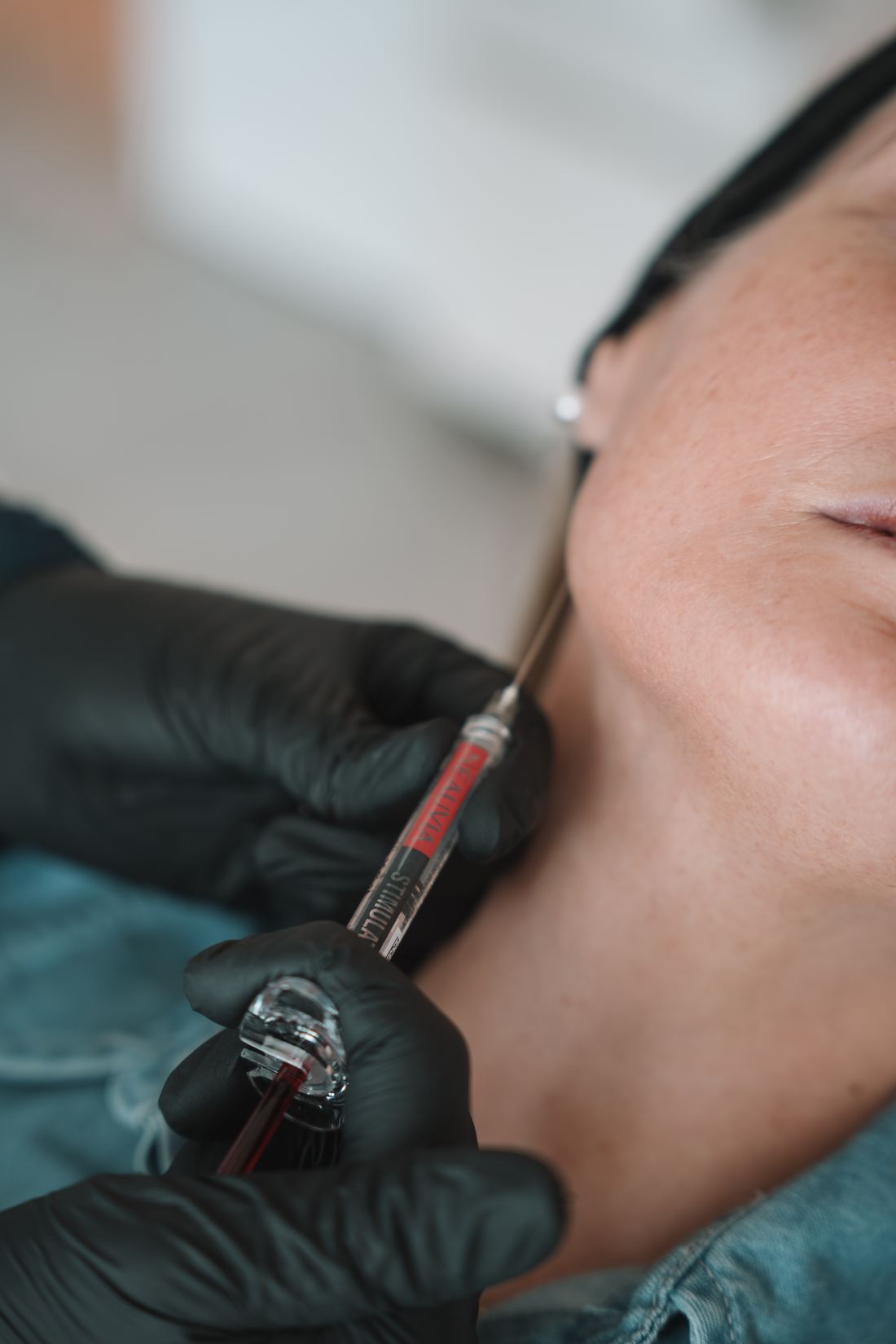 Aplicación de tratamiento facial con criterio médico